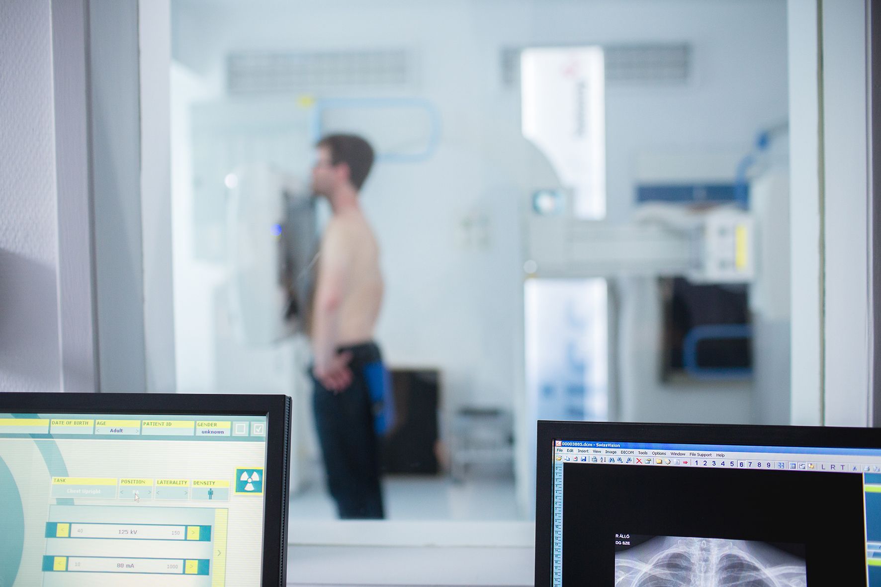 Férfispecifikus szűrővizsgálatok: a megelőzés életeket menthet Férfispecifikus szűrővizsgálatok: a megelőzés életeket menthet